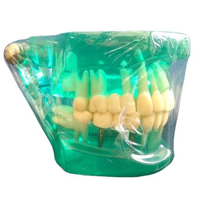 DTC Orthodontik Typodont-Klammern Modell für manuelle und OEM