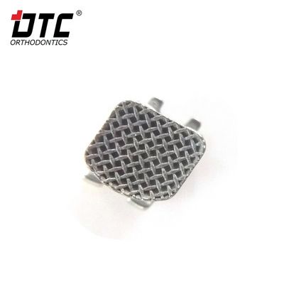 DTC-Bright-Serie-Metallklammern - Der Schlüssel zu einer erfolgreichen Kieferorthopädie der Klasse II