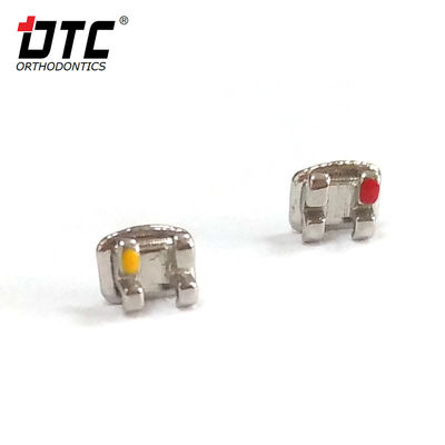 DTC-Bright-Serie-Metallklammern - Der Schlüssel zu einer erfolgreichen Kieferorthopädie der Klasse II