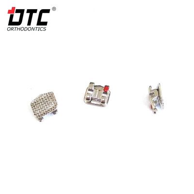 DTC-Bright-Serie-Metallklammern - Der Schlüssel zu einer erfolgreichen Kieferorthopädie der Klasse II