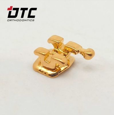 Erleben Sie die beste Kieferorthopädie mit den CE-zertifizierten Goldklammern von DTC Ortho