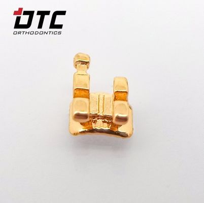 Erleben Sie die beste Kieferorthopädie mit den CE-zertifizierten Goldklammern von DTC Ortho