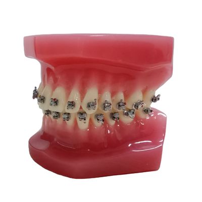 DTC Orthodontik Typodont-Klammern Modell für manuelle und OEM